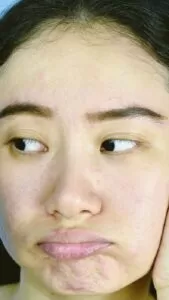 how to brighten dull skin naturally